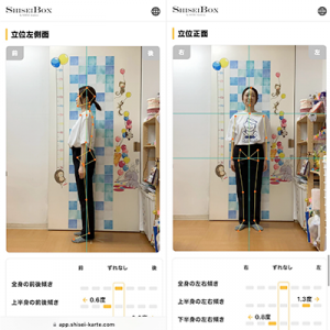 AI姿勢分析システム「SHISEI BOX ― カルティ」